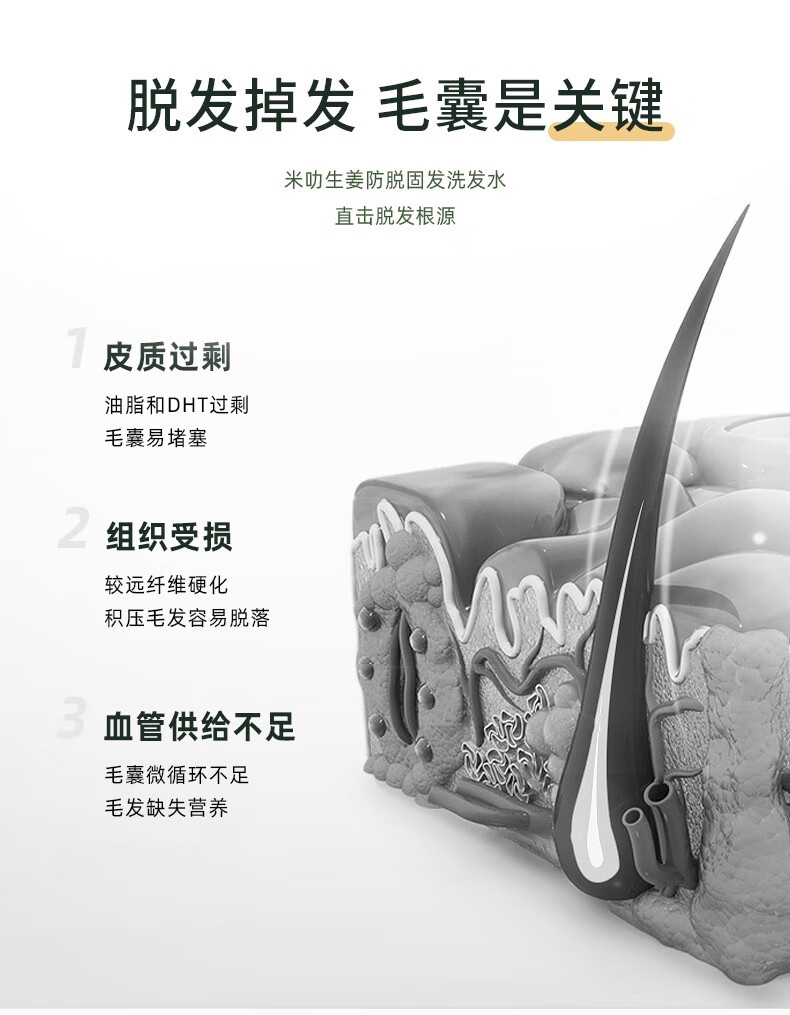 脫發掉發毛囊是關鍵   米叻生姜防脫固發洗發水   直擊脫發根源   皮質過剩 油脂和DHT過剩 毛囊易堵塞   組織受損 較遠纖維硬化 積壓毛發容易脫落   血管供給不足 毛囊微循環不足 毛發缺失營養
